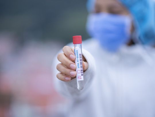 W Kraju Libereckim ruszyły komercyjne testy na koronawirusa