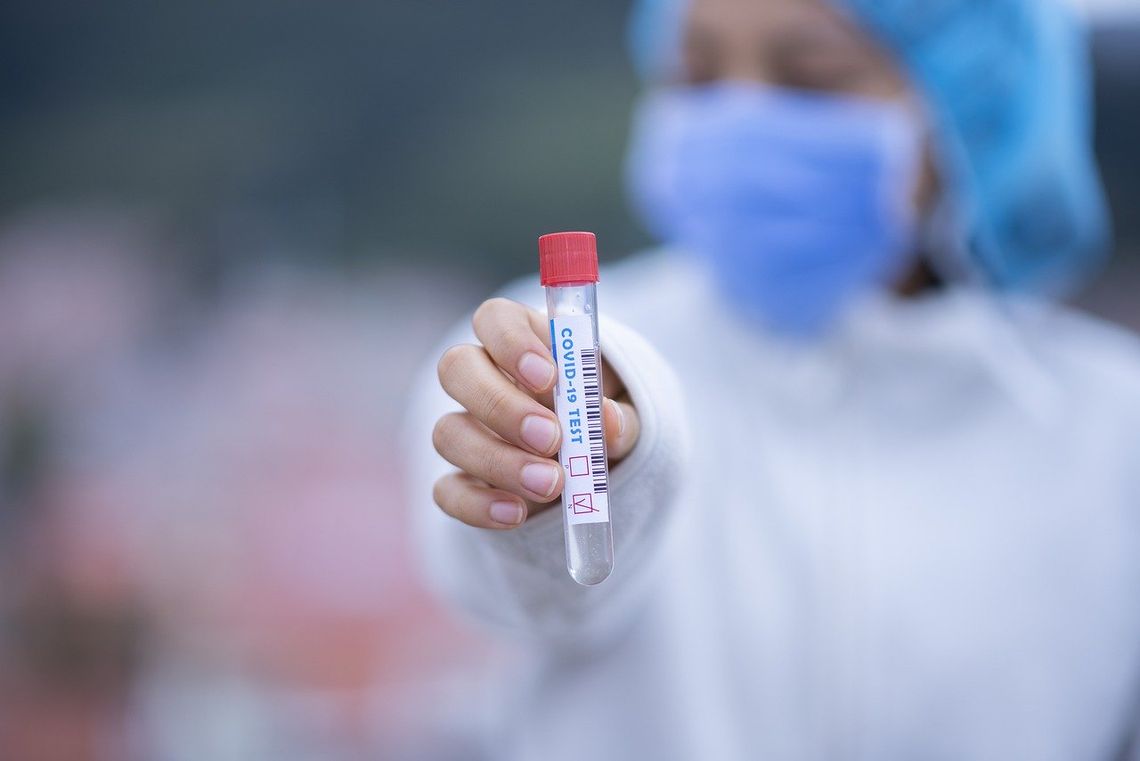 W Kraju Libereckim ruszyły komercyjne testy na koronawirusa